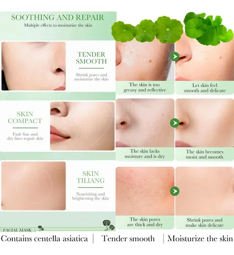 Centella Asiatica Moisturizing Facial Soothing Repair Face