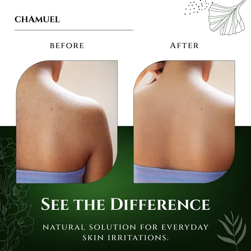 Jabón Corporal Chamuel Tea Tree Natural 350 Ml Para Piel Con