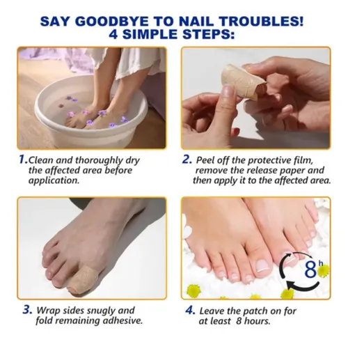 +parches Para Hongos En Las Uñas De Los Pies (3 Piezas).
