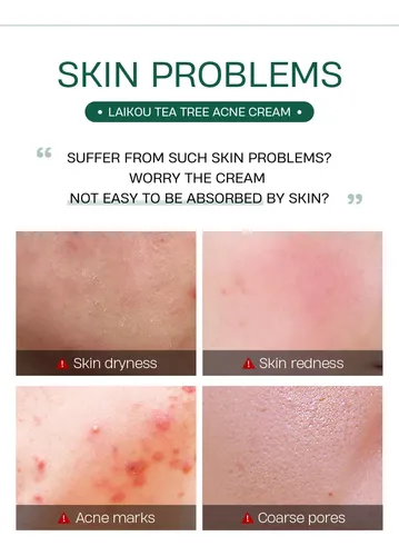 Crema Facial Reparadora Laikou: Adiós Al Acné Y Poros