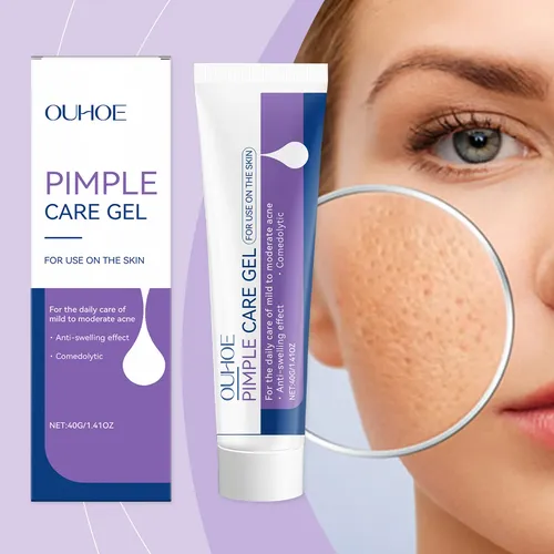 Gel Calmante Para Puntos Negros Ouhoe, Limpiador Suave De Po
