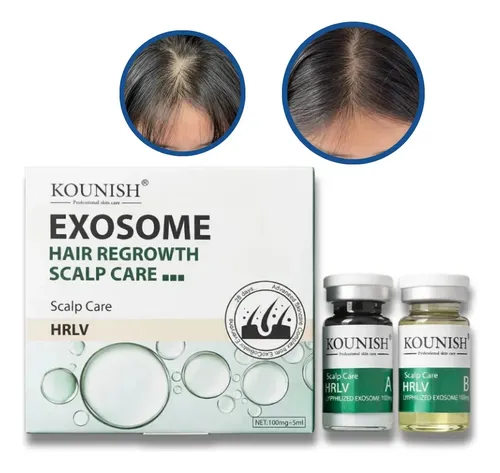 Tratamiento Capilar con Exosomas Kounish HRLV