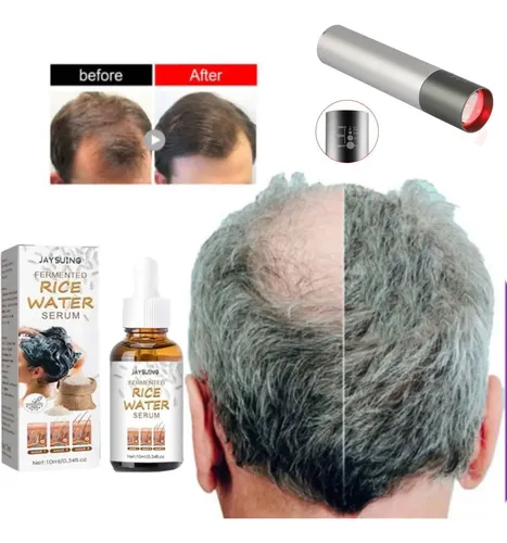 Serum Vitalidad Pelo Fuerte + Láser Portable Estimula Grosor