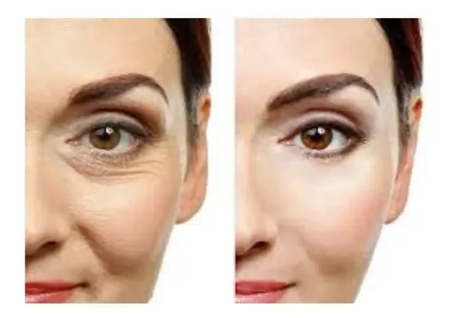 Reparador Intensivo De Ojeras Idraet Sublime Eyes Peptides