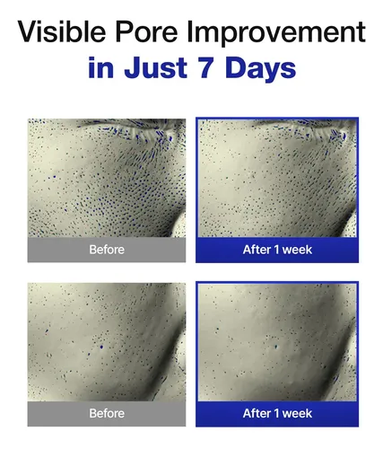 Almohadillas Tónicas Exfoliantes Kioskin Brightening Con Aha