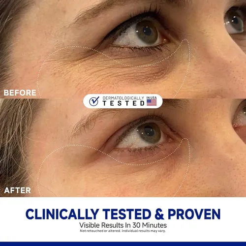 Parches De Ojos Con Péptidos Y Colágeno