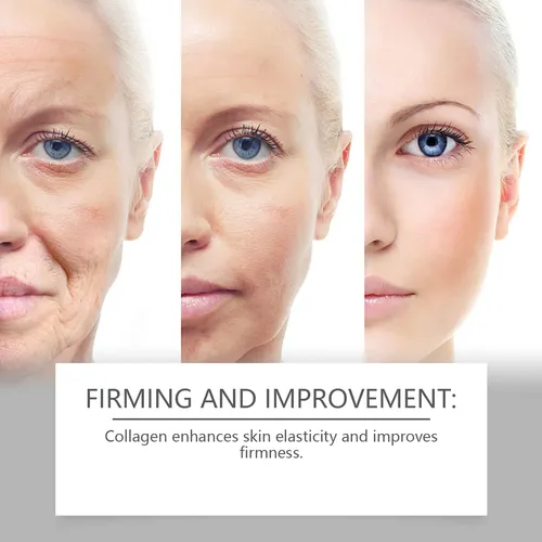Crema Facial Hoygi Con Vitamina C Y Retinol