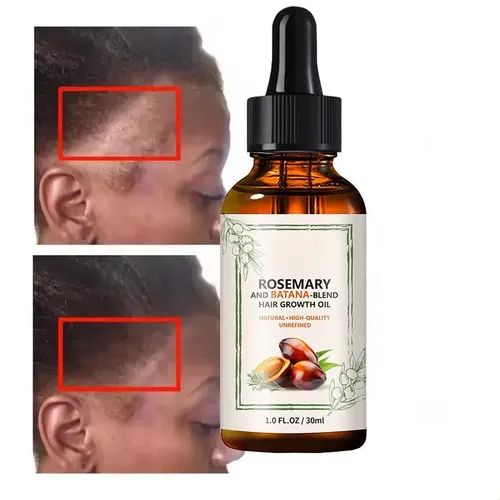 Aceite Capilar Battana 30 Ml (1 Unidad)