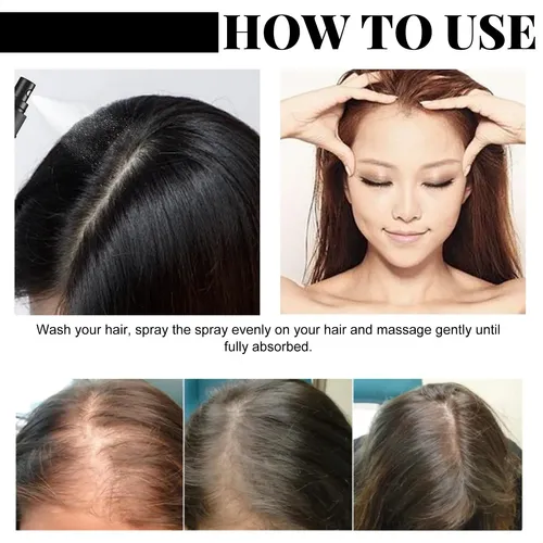 El Spray Para El Cabello Jaysuing Batana Hidrata Profundamen
