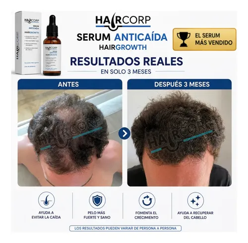 Kit Anticaída de Haircorp con Shampoo y Sérum para el Crecimiento del Pelo