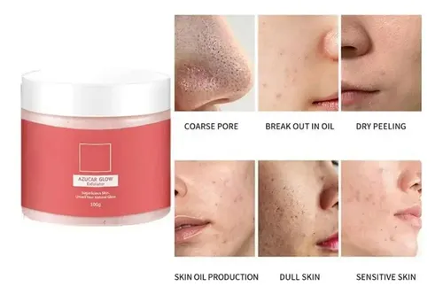 Azúcar Glow Crema,blanqueador Y Exfoliante,limpieza Profunda