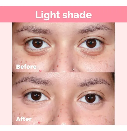 Corrector E Iluminador Ojos Elizabeth Mott 5ml Tono Claro