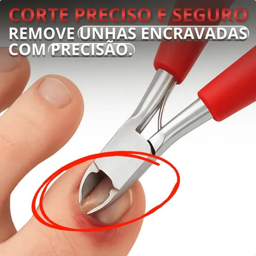Cortador De Uñas Encarnadas Profesional Acero Inoxidable