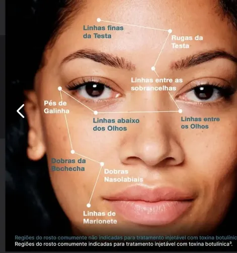 Sérum Facial Skinceuticals P-tiox Para Día Y Noche, 30 Ml