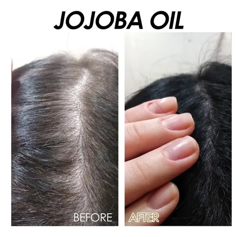 – Aceite De Jojoba Orgánico, Prensado En Frío, Aceite