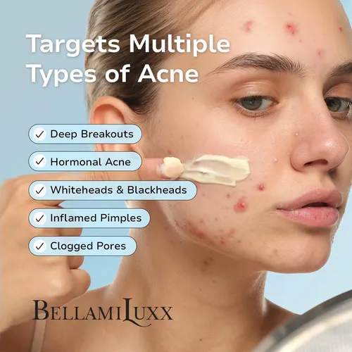Crema De Tratamiento Del Acné Bellamiluxx Para Rostro Con 2% Acneica Día/noche