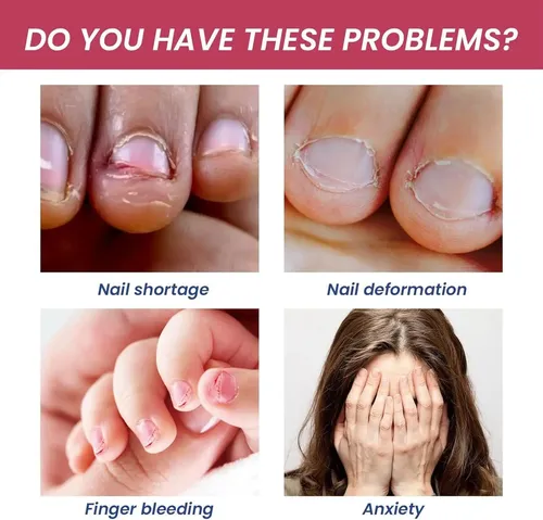 No Morderse Mas Las Uñas 100% Calidad Premium Incoloro