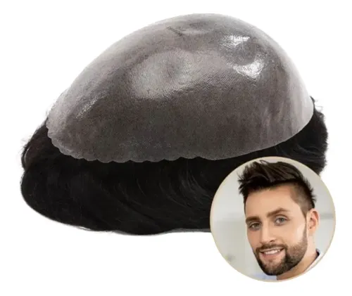 Prótesis Capilar Masculina – Castaño Oscuro