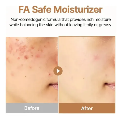 Purito Oatin Calming Gel Crema Calmante Previene Brotes Acne