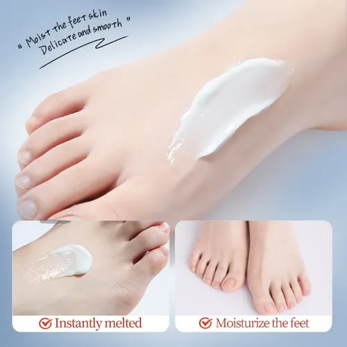 Crema Para Pies Hidratante Antigrietas Con Urea 110g Sadoer