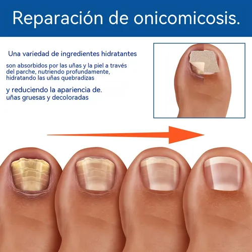 Parche Para El Cuidado De Las Uñas, Suave Y Limpio, Transpir 60 Patches As Described
