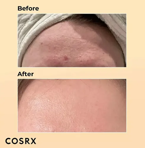 Cosrx 96% Esencia Tonico Advanced Snail Baba De Caracol