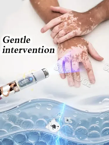 Kit De Tratamiento Láser Para Vitíligo De Segunda Generación