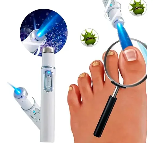 Tratamiento Láser Uñas Hongos Onicomicosis Manos Pies Eficaz