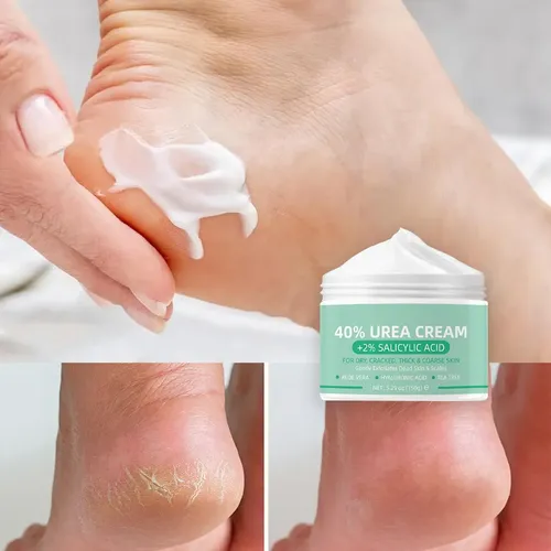 Cjw Crema De Urea 40% + 2% Ácido Salicílico Para Pies Secos