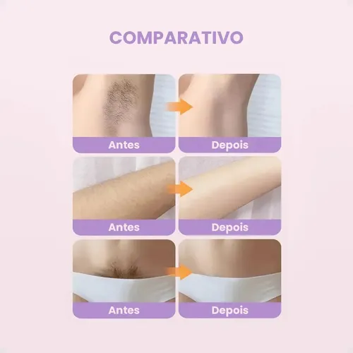 Faa Depiladora Eléctrica 2 En 1 Para Mujer, Vello Corporal,