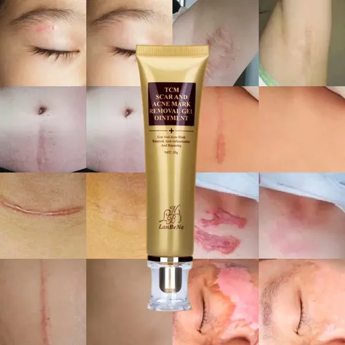 Gel Cicatrices Manchas Estrias Acne Crema No Cicatricure