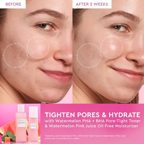 Tónico Hermético Watermelon Glow, 150 Ml, Receta Que Brilla