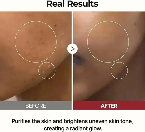 Dr.melaxin Peel Shot Glow White Rice Toner Iluminador Facial