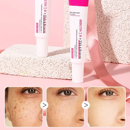 Crema Facial Antimanchas Despigmentante Melasma Paño 30 G Ll