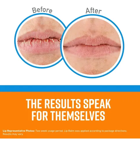 Bálsamo Labial O’keeffe’s Cooling Lip Repair X 2 Unidades Us