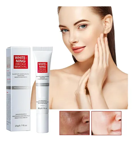 Crema Facial Hidratante For Manchas De Pigmento Aclarante