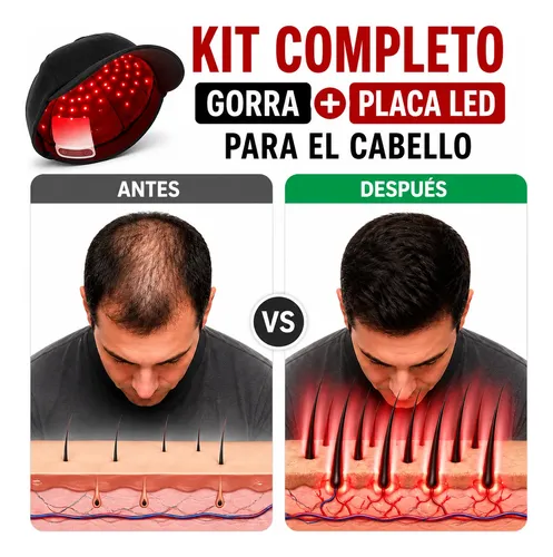 Gorra Anticaída Cabello Terapia Led Para Crecimiento Capilar