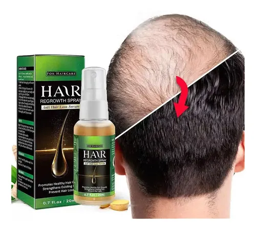 W El Sérum Para El Crecimiento Del Cabello Promueve El W