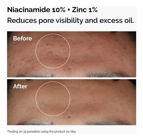 The Ordinary Sérum Niacinamida Ácido Hialurónico 2x30ml Rostro
