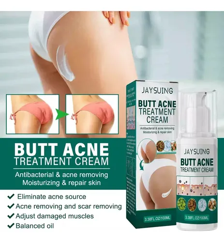 Crema Reparadora De Acné En Glúteos De 2 Piezas, Hidratante
