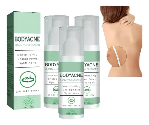 3×spray For Eliminar El Acné Corporal For Espalda, Cuello .