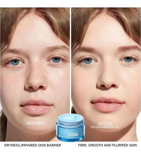 Crema Facial Hydro Boost Ácido Hialurónico 1.76 Oz