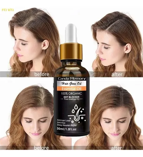 Aceite Capilar Con Extracto De Jengibre (pack De Dos)