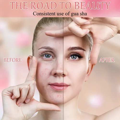 Gua Sha Facial Tool Sherr, Piedras De Masaje De Resina, 24 U