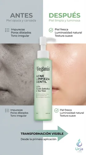 Veganis Gel Acne Limpieza Gentil 150 Ml Piel Acneica