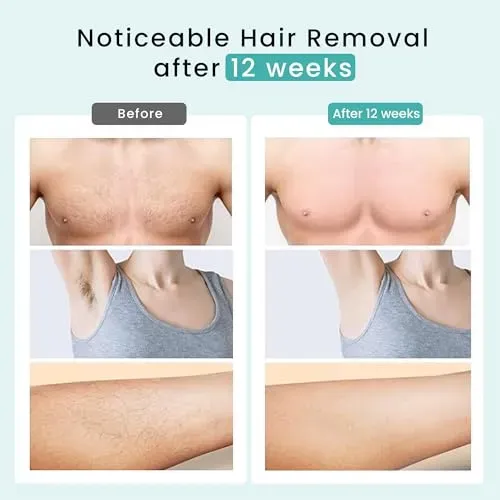 Cuidado De La Piel Rasuradora Mujer Soft Touch De Uso Diario
