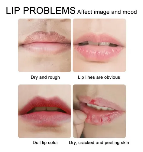 Máscara Labial Hidratante 60g (20 Pares) – Reduce Arrugas