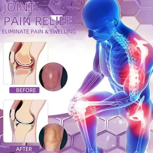 Gel De Masaje Calmante Para Aliviar El Dolor Y La Artritis C