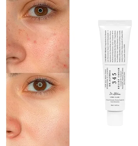 Crema Diaria Para El Alivio Facial, Cuidado Calmante Y Para  Todo Tipo De Piel Día/noche