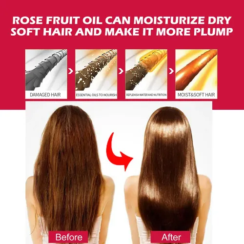 Aceite Facial De Rosa Mosqueta Eelhoe Hidratante Facial Y Corpora